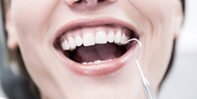 치과 기구로 잇몸 상태를 살펴보는 모습