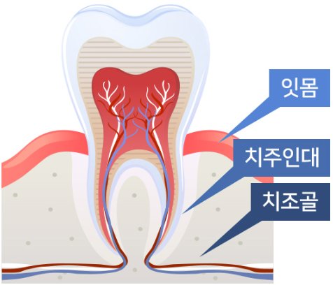 치아를 둘러싼 잇몸, 치주인대, 치조골 구조 그림