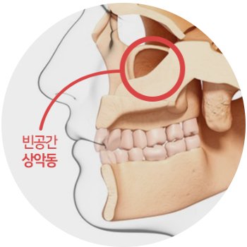 코 옆 빈 공간인 상악동 위치 그림